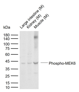 Phospho-MEK6 (Ser202) Rabbit Polyclonal Antibody
