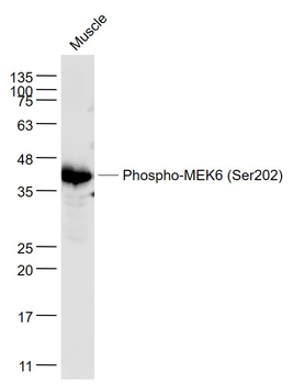 Phospho-MEK6 (Ser202) Rabbit Polyclonal Antibody