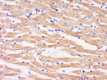 Phospho-MEK6 (Ser202) Rabbit Polyclonal Antibody