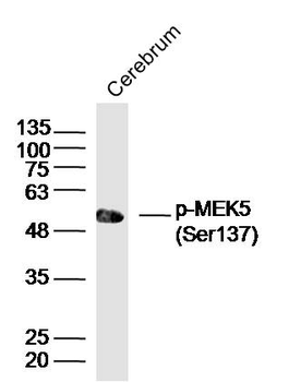Phospho-MEK5 (Ser137) Rabbit Polyclonal Antibody