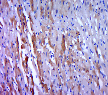 Phospho-MEK7 (Ser271 + Thr275) Rabbit Polyclonal Antibody
