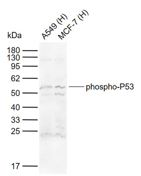 Phospho-P53 (Ser15) Rabbit Polyclonal Antibody