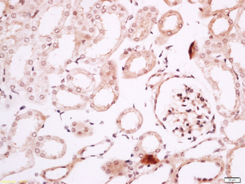 Phospho-P53 (Ser15) Rabbit Polyclonal Antibody