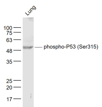Phospho-P53 (Ser315) Rabbit Polyclonal Antibody