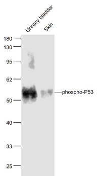 Phospho-P53 (Ser33) Rabbit Polyclonal Antibody
