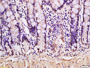 Phospho-P53 (Ser33) Rabbit Polyclonal Antibody