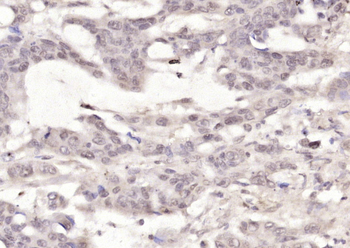 Phospho-P53 (Ser33) Rabbit Polyclonal Antibody