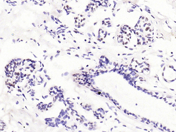 Phospho-P53 (Ser33) Rabbit Polyclonal Antibody