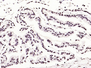 Phospho-P53 (Ser33) Rabbit Polyclonal Antibody