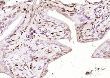 Phospho-P53 (Ser33) Rabbit Polyclonal Antibody