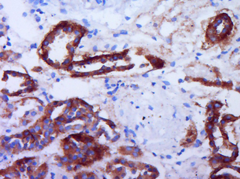 Phospho-P53 (Ser37) Rabbit Polyclonal Antibody