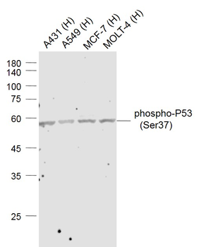 Phospho-P53 (Ser37) Rabbit Polyclonal Antibody