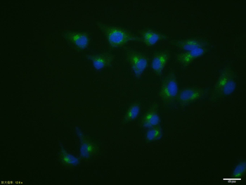 Phospho-P53 (Ser46) Rabbit Polyclonal Antibody