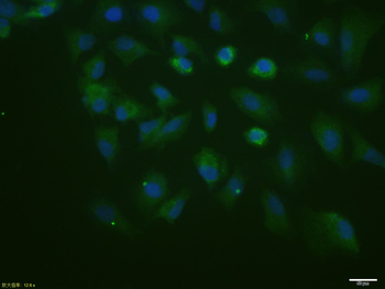 Phospho-P53 (Ser46) Rabbit Polyclonal Antibody