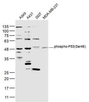 Phospho-P53 (Ser46) Rabbit Polyclonal Antibody