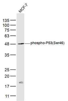 Phospho-P53 (Ser46) Rabbit Polyclonal Antibody