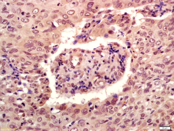 Phospho-P53 (Ser46) Rabbit Polyclonal Antibody