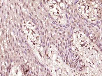 Phospho-P53 (Thr18) Rabbit Polyclonal Antibody