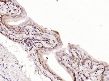 Phospho-P53 (Thr18) Rabbit Polyclonal Antibody