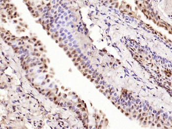 Phospho-P53 (Thr18) Rabbit Polyclonal Antibody