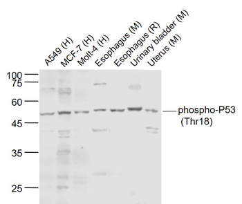 Phospho-P53 (Thr18) Rabbit Polyclonal Antibody
