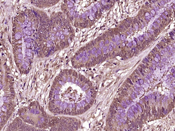 Phospho-P53 (Thr81) Rabbit Polyclonal Antibody