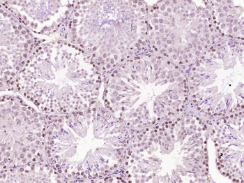 Phospho-p53BP1 (Ser25 + Ser29) Rabbit Polyclonal Antibody