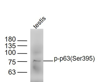 Phospho-p63 (Ser395) Rabbit Polyclonal Antibody