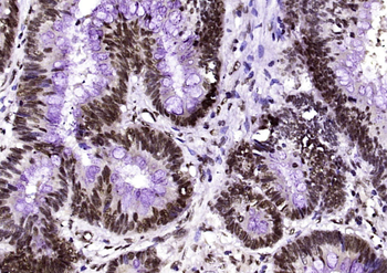 Phospho-p63 (Ser455) Rabbit Polyclonal Antibody