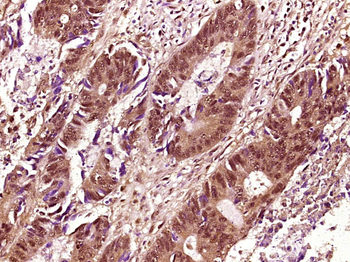 Phospho-p63 (Ser455) Rabbit Polyclonal Antibody