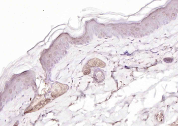 Phospho-p73 (Tyr99) Rabbit Polyclonal Antibody