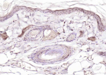 Phospho-p73 (Tyr99) Rabbit Polyclonal Antibody