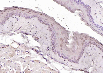 Phospho-p73 (Tyr99) Rabbit Polyclonal Antibody