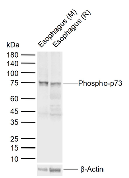 Phospho-p73 (Tyr99) Rabbit Polyclonal Antibody