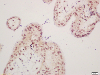 Phospho-p73 (Tyr99) Rabbit Polyclonal Antibody