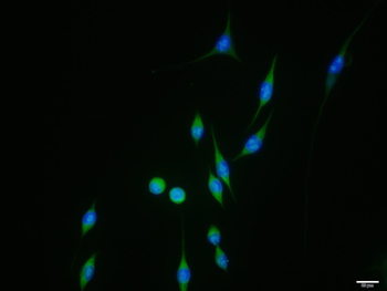 Phospho-RPS6KB1 (Ser417) Rabbit Polyclonal Antibody