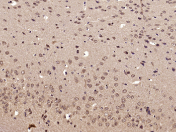 Phospho-RPS6KB1 (Ser417) Rabbit Polyclonal Antibody