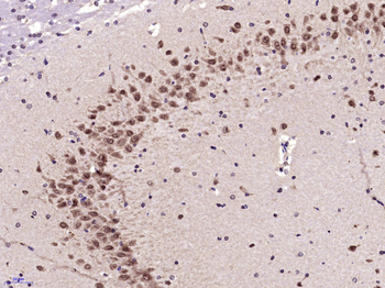 Phospho-RPS6KB1 (Ser417) Rabbit Polyclonal Antibody