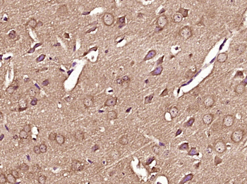 Phospho-RPS6KB1 (Thr412) Rabbit Polyclonal Antibody