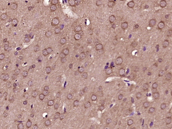 Phospho-RPS6KB1 (Thr412) Rabbit Polyclonal Antibody