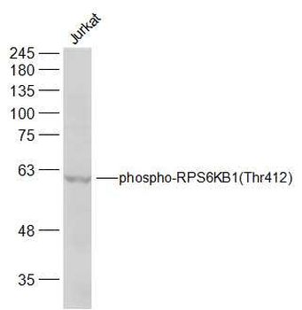 Phospho-RPS6KB1 (Thr412) Rabbit Polyclonal Antibody