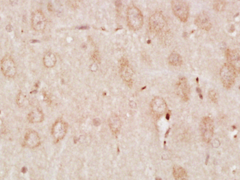 Phospho-RPS6KB1 (Ser427) Rabbit Polyclonal Antibody