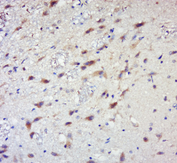 Phospho-RPS6KB1 (Ser441+Thr444) Rabbit Polyclonal Antibody