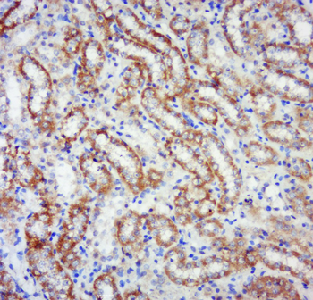 Phospho-RPS6KB1 (Ser441+Thr444) Rabbit Polyclonal Antibody