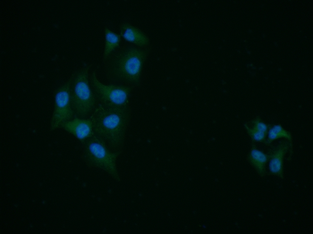 P70 S6 Kinase Beta Rabbit Polyclonal Antibody