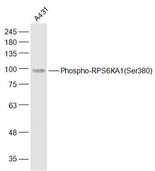 Phospho-RPS6KA1 (Ser380) Rabbit Polyclonal Antibody