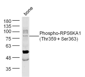 Phospho-RPS6KA1 (Thr359 + Ser363) Rabbit Polyclonal Antibody