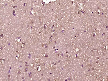 Phospho-RPS6KA1 (Thr348) Rabbit Polyclonal Antibody