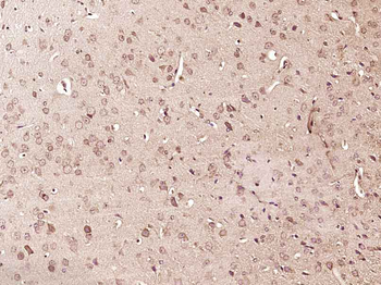 Phospho-RPS6KA1 (Thr348) Rabbit Polyclonal Antibody