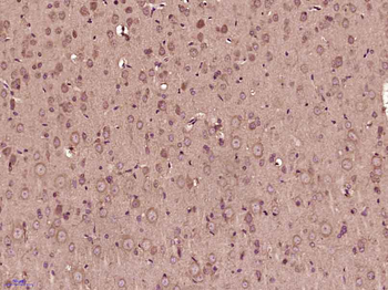 Phospho-RPS6KA1 (Thr348) Rabbit Polyclonal Antibody